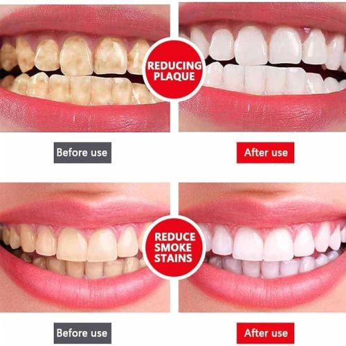 Sp-4 Ultra Whitening Toothpaste Probiotic Stain Removing Toothpaste