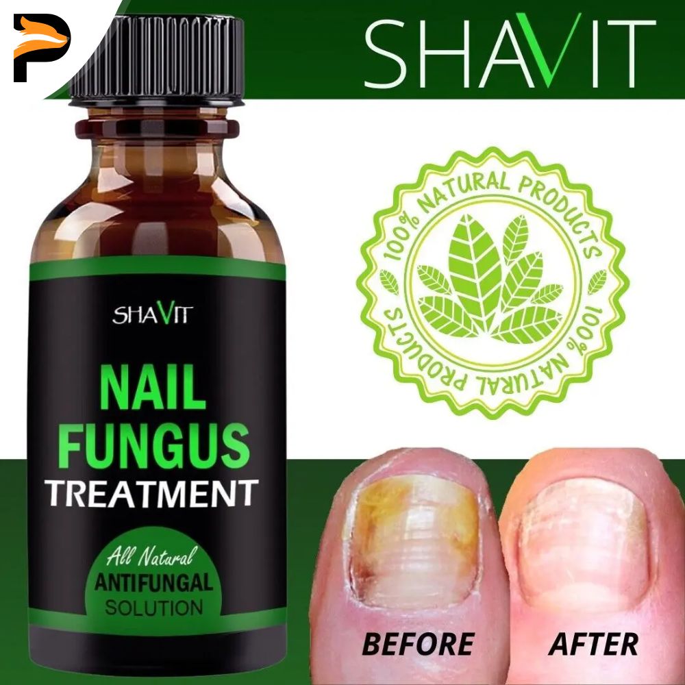 Fast Nail Fungus Treatment Gel – Nail Repair Essence Serum