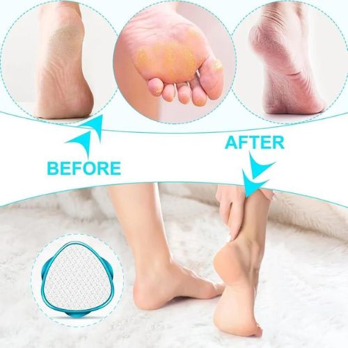 Double-Sided Nano Glass Callus Remover & Crystal Hair Eraser 2-in-1
