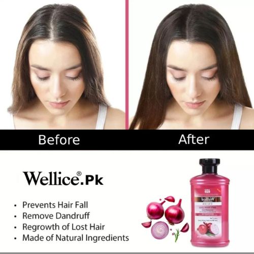 Wellice Onion Anti Hair Loss Hair Oil 150ml
