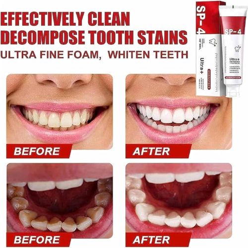 Sp-4 Ultra Whitening Toothpaste Probiotic Stain Removing Toothpaste