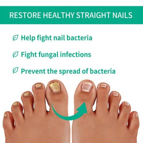Fast Nail Fungal Treatments Nail Repair Essences Serum
