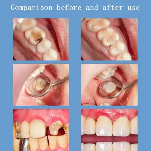 Sp-4 Ultra Whitening Toothpaste Probiotic Stain Removing Toothpaste