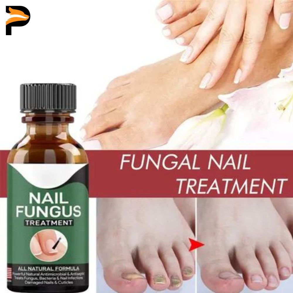 Fast Nail Fungus Treatment Gel – Nail Repair Essence Serum