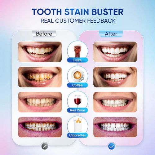 Whitening Toothpaste with Niacinamide & Probiotics | Body Accel | Bright Smile Formula