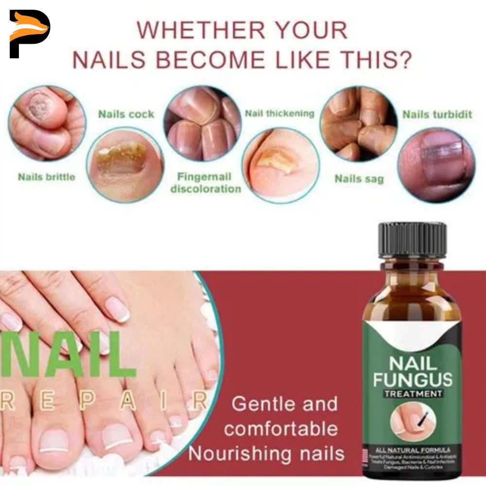 Fast Nail Fungus Treatment Gel – Nail Repair Essence Serum