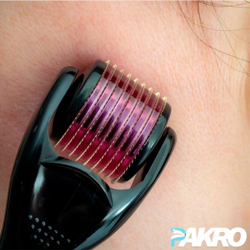 Close-up of a black hair removal tool with pink and gold components on skin, featuring the 'PAKRO' brand.